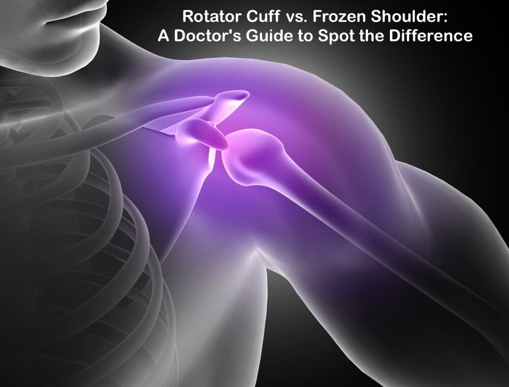 Rotator Cuff vs. Frozen Shoulder - A Doctor's Guide to Spot the Difference